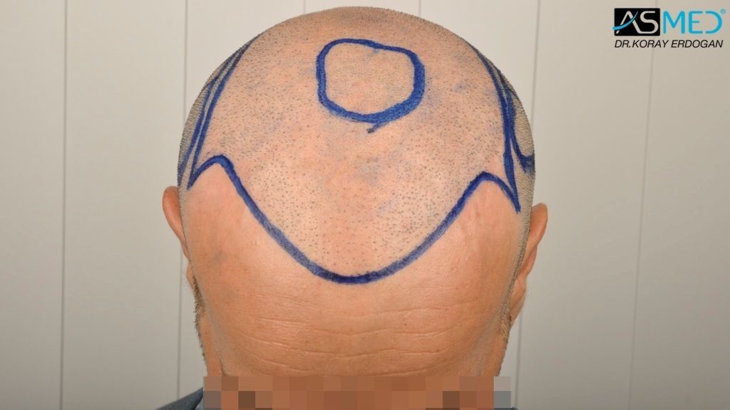 Maschera per capelli da proteina per capelli